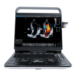 Ultrasonido Chison ebit 60