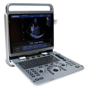 Ultrasonido Chison EBit 50