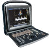 Ultrasonido Chison Eco 5