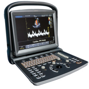 Ultrasonido Chison Eco 5