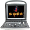 Ultrasonido Chison Eco 6