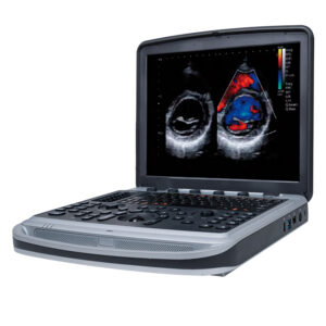 Ultrasonido Chison SonoBook 9